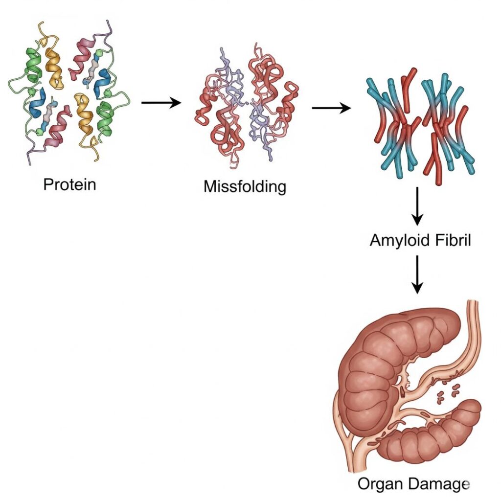 Protein Misfolding Disorder | amyloidosissupport