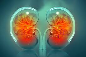 Kidney Failure Managed in Light Chain Myeloma .