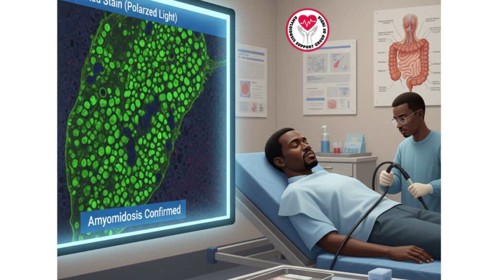 Sigmoid Colon Biopsy as a Diagnostic Tool for Amyloidosis