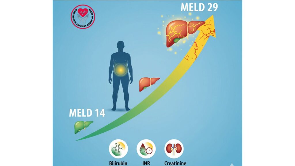 Sudden Progression of Liver Disease
