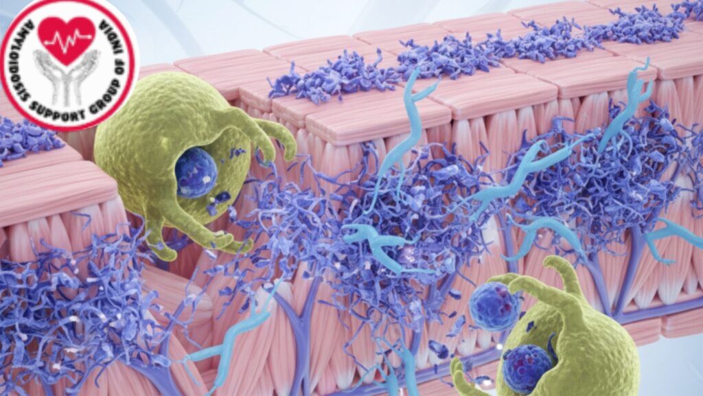 Anselamimab: Investigational Monoclonal Antibody for Targeting Amyloid Fibrils to Enhance Organ Function